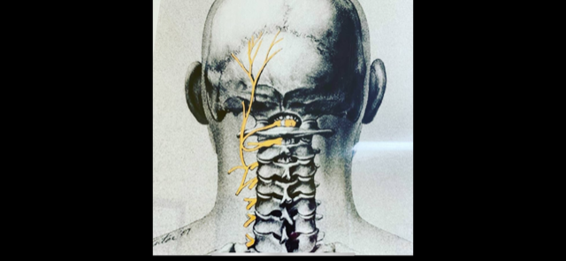 You are currently viewing Headaches and hand/arm numbness and pain caused by tight muscles in the neck
